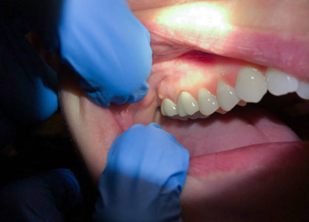 Best Cosmetic Emergency Dentistry in Brighton, IL